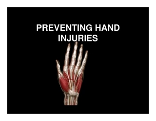 Preventing-Hand-Injuries.pdf