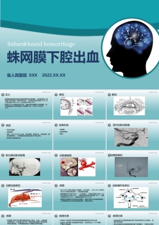 2022蛛网膜下腔出血PPT创意简约医疗教学各种疾病医理PPT模板.pptx
