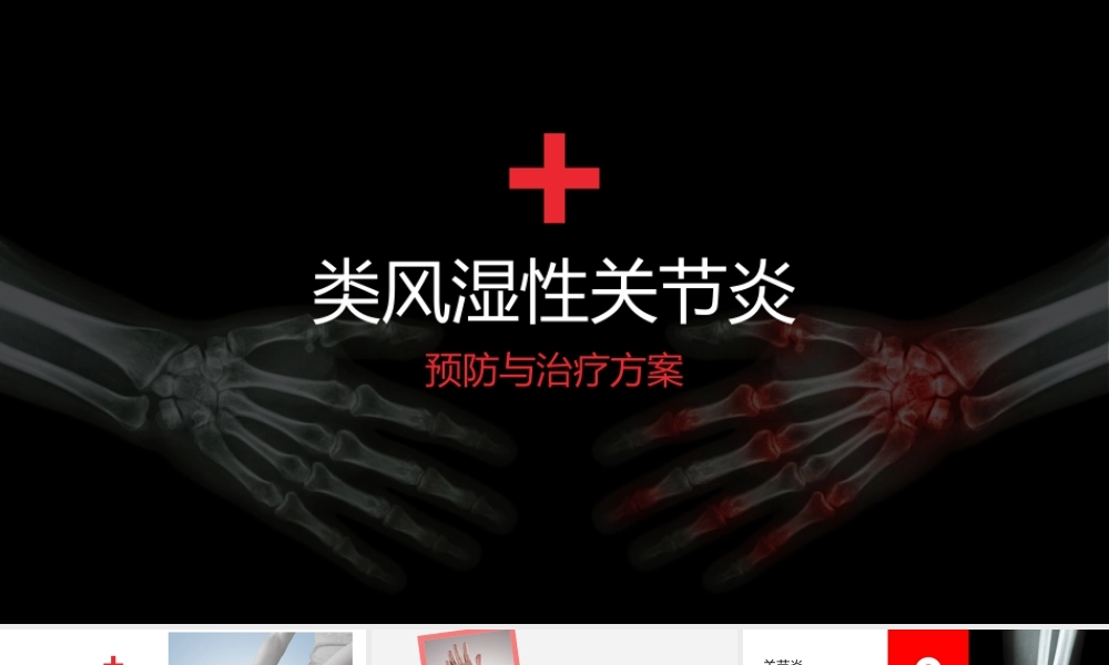 类风湿性关节炎PPT模板pic149.pptx