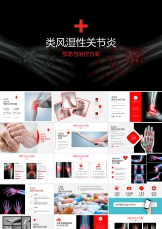 类风湿性关节炎PPT模板pic149.pptx