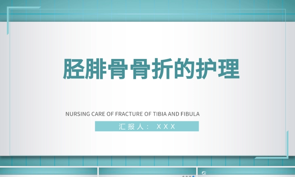 2022胫腓骨骨折护理PPT简约个性医学护理通用PPT.pptx
