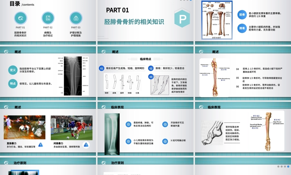 2022胫腓骨骨折护理PPT简约个性医学护理通用PPT.pptx
