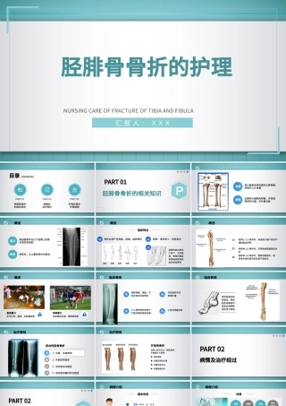 2022胫腓骨骨折护理PPT简约个性医学护理通用PPT.pptx