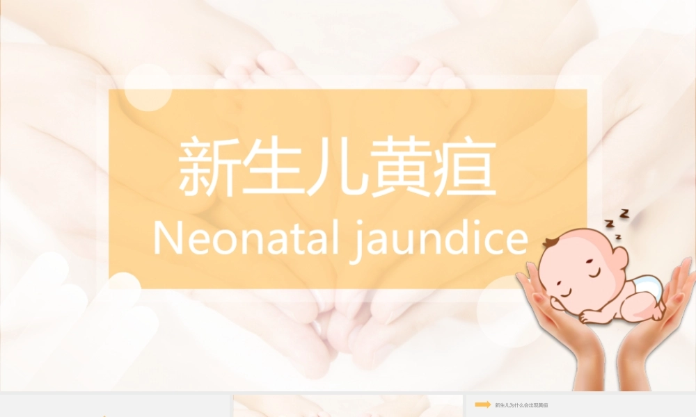 2022新生儿黄疸护理PPT创意简约医学行业通用PPT.pptx