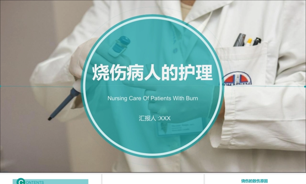 烧伤护理PT系列 (1).pptx