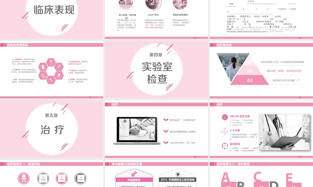 新生儿窒息复苏.pptx